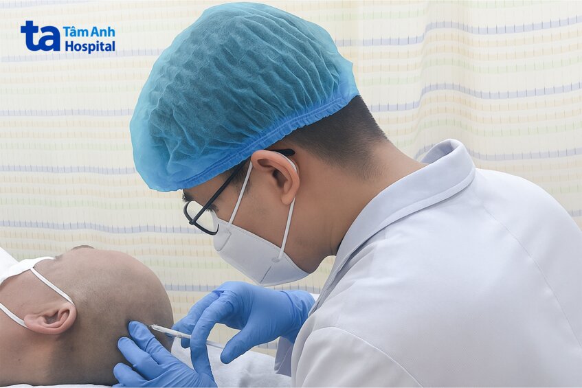bác sĩ tiêm hoạt chất kích thích mọc tóc cho khách hàng