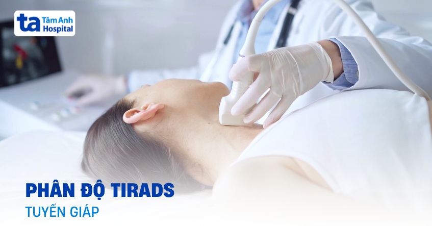 Bảng phân độ Tirads tuyến giáp trong siêu âm mới nhất