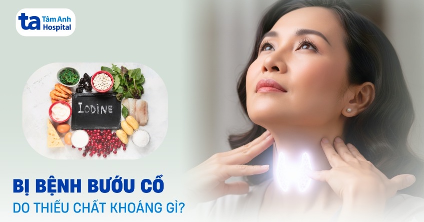 Bệnh bướu cổ là do thiếu chất khoáng gì?