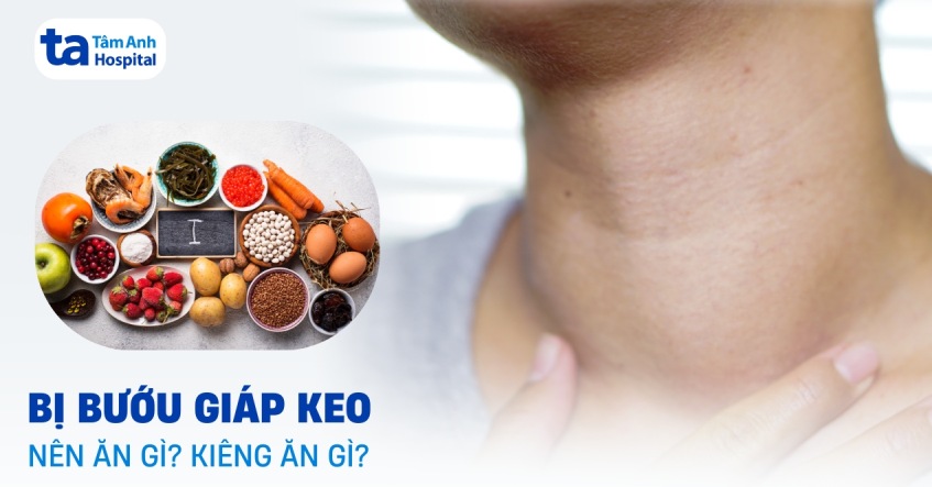Bị bướu giáp keo kiêng ăn gì, nên ăn gì?