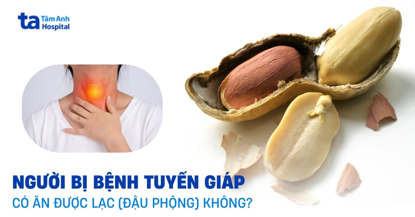 bị tuyến giáp có ăn được lạc không