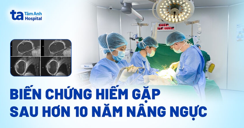 Biến chứng hiếm gặp sau hơn 10 năm nâng ngực
