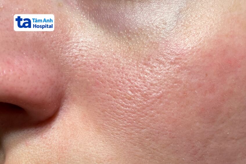 biểu hiện bất thường cần cảnh giác