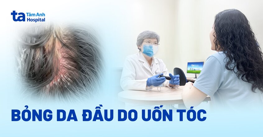 Bỏng da đầu do uốn tóc