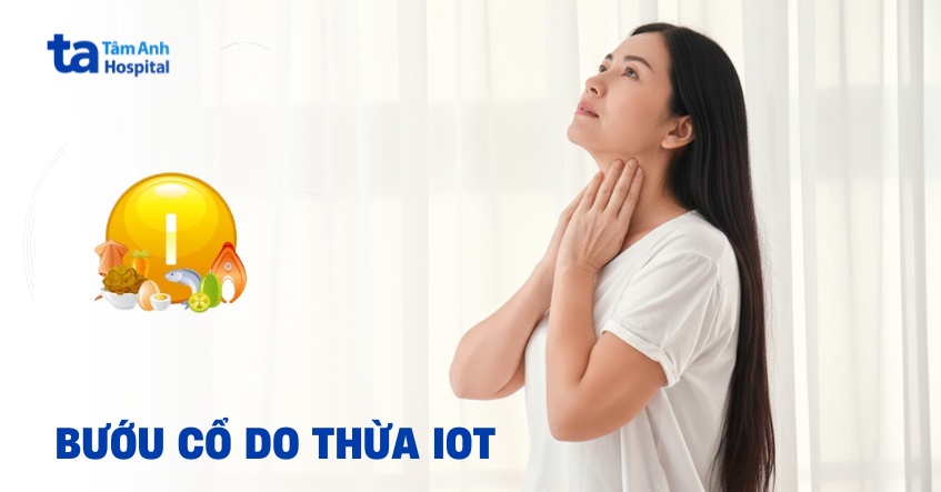 Bướu cổ do thừa iot: Nguyên nhân, triệu chứng và cách điều trị