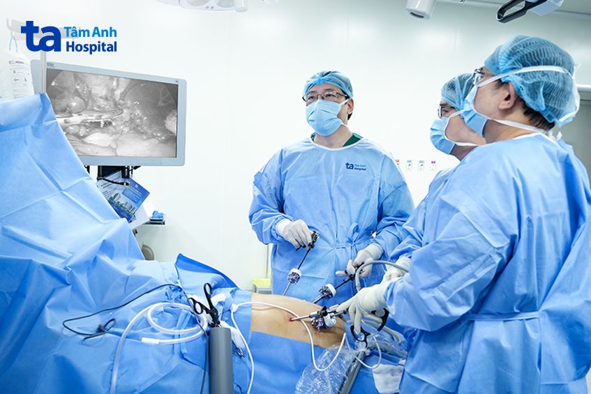 ca phẫu thuật cắt bảo tồn dạ dày