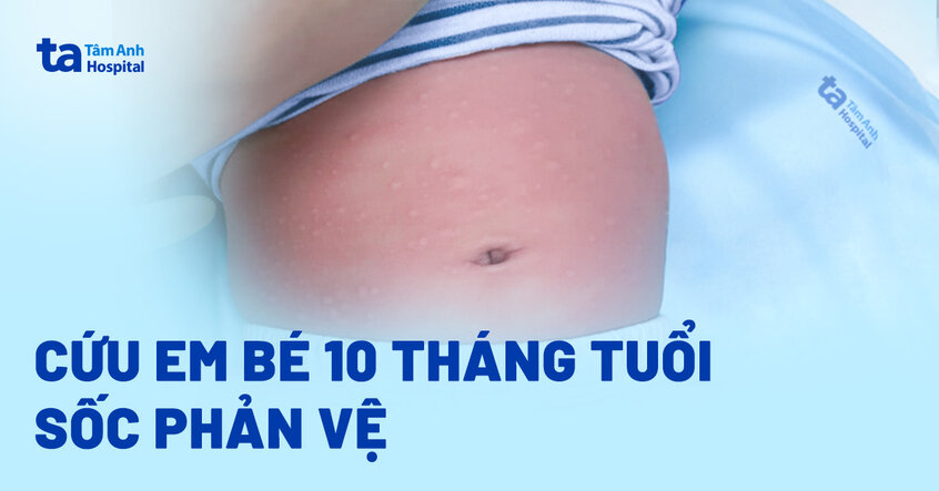 Cứu bé 10 tháng tuổi sốc phản vệ