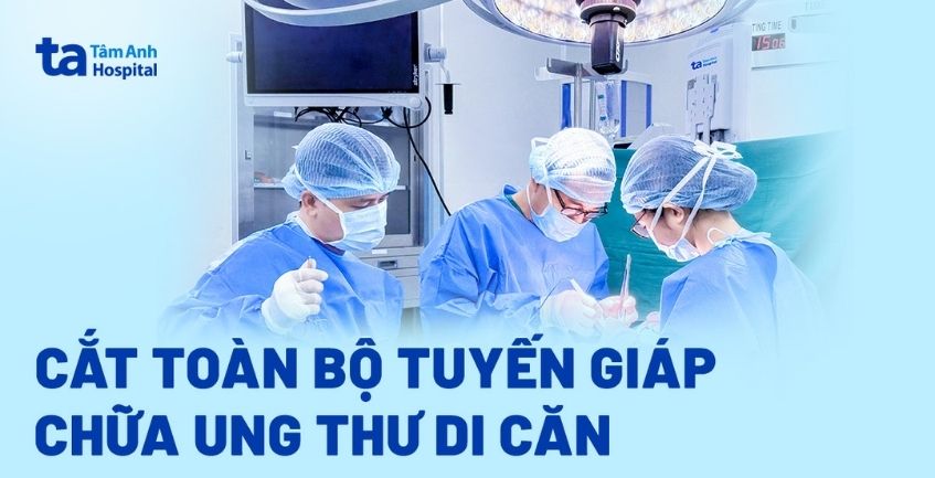 Cắt toàn bộ tuyến giáp chữa ung thư di căn