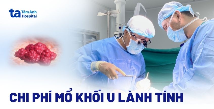 Chi phí mổ khối u lành tính là bao nhiêu?