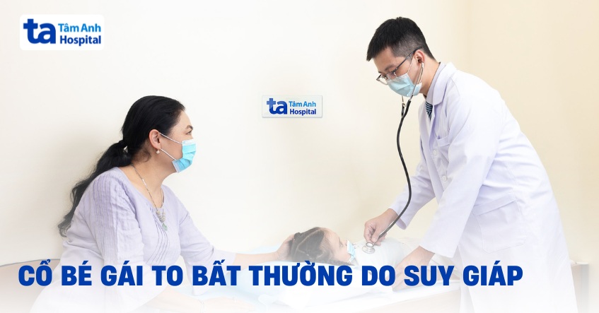 Cổ bé gái to bất thường do suy giáp