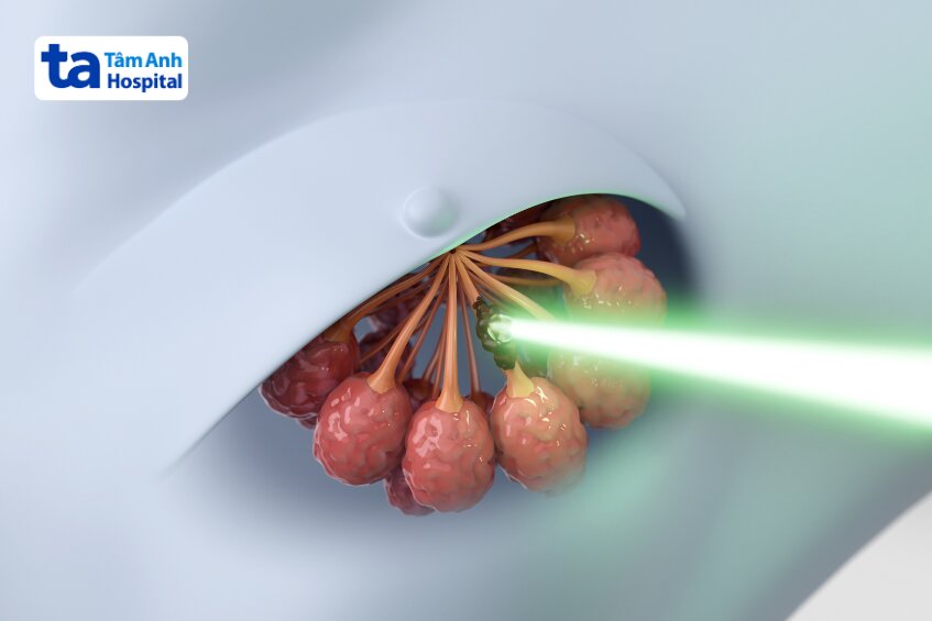 có thể áp dụng trong điều trị ung thư vú