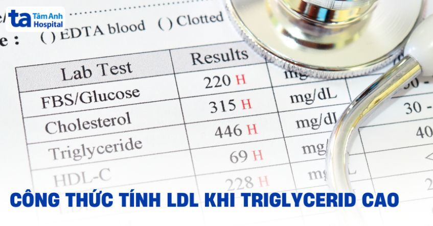 Công thức tính LDL khi Triglycerid cao và cách áp dụng đúng