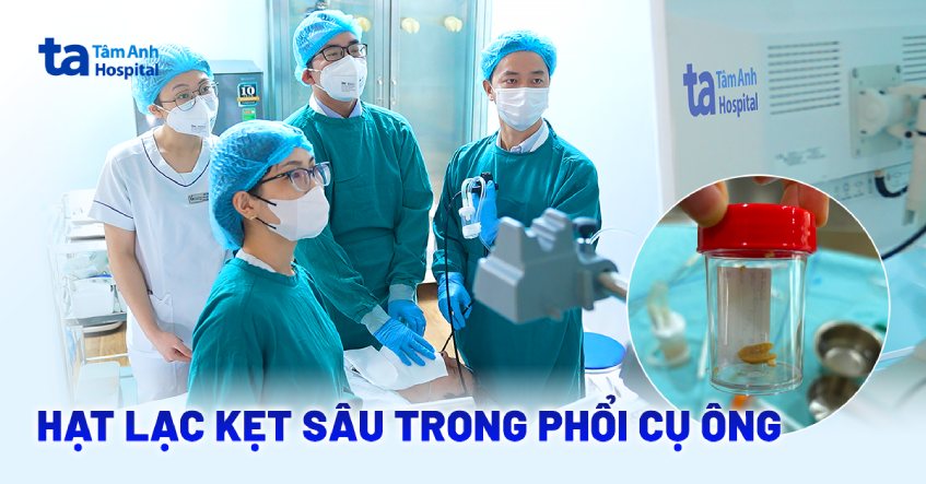 cụ ông 88 tuổi hóc hạt lạc sâu trong phổi
