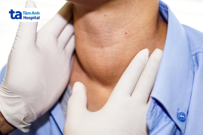 cường giáp thứ phát là rối loạn hiếm gặp do tuyến yên