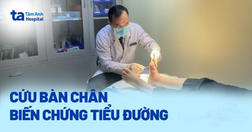 Cứu bàn chân nhiễm trùng do biến chứng tiểu đường cho cụ ông 80 tuổi