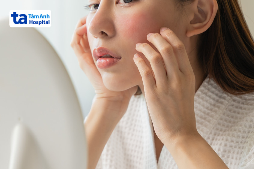 Phụ nữ soi gương với vùng da mặt ửng đỏ, biểu hiện da nhạy cảm cần dưỡng chất làm mềm