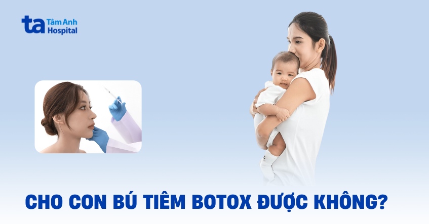 Sau sinh và đang cho con bú tiêm botox gọn hàm được không?