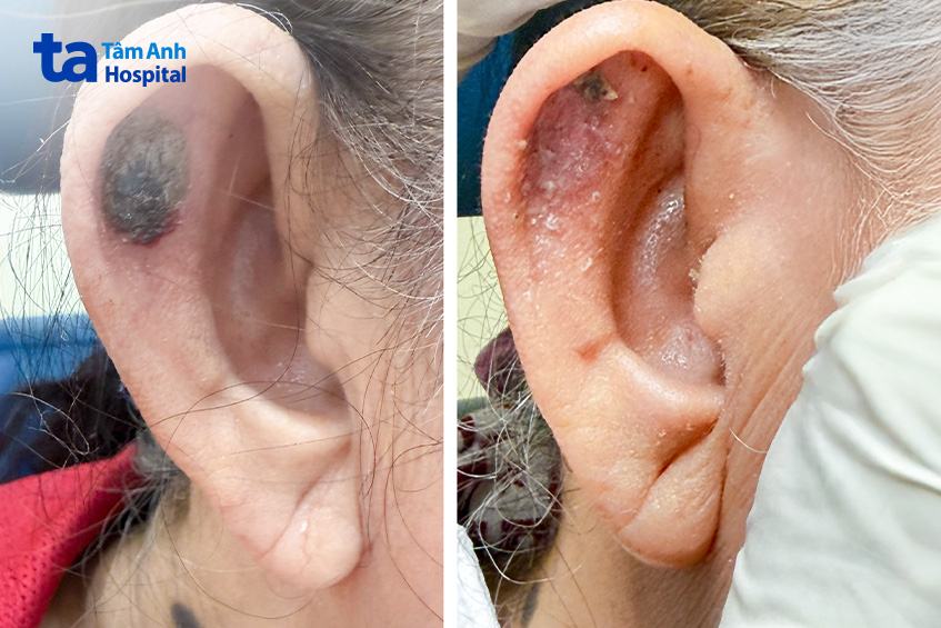 dáng tai được phục hồi