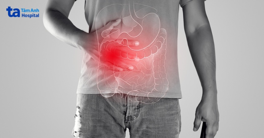 đau quặn bụng hoặc đau âm ỉ vùng bụng dưới sau xạ trị