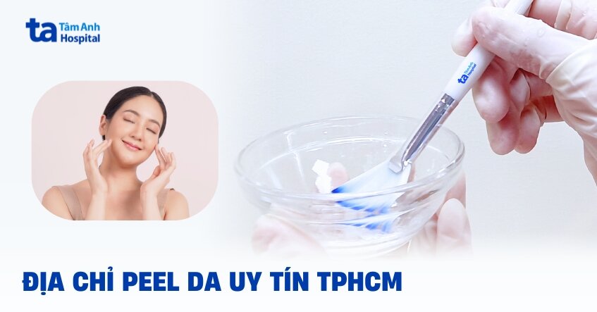 Địa chỉ peel da uy tín tại TPHCM đảm bảo tốt và hiệu quả