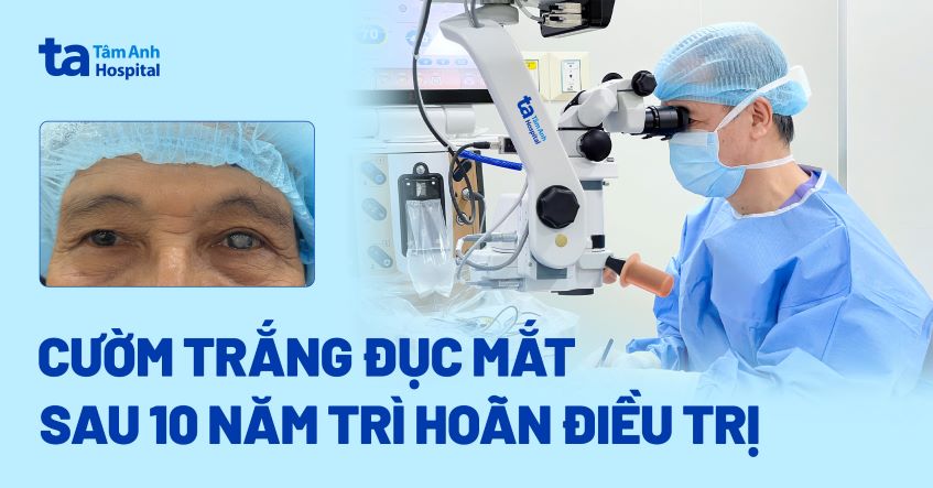 Cườm trắng đục mắt sau 10 năm trì hoãn điều trị