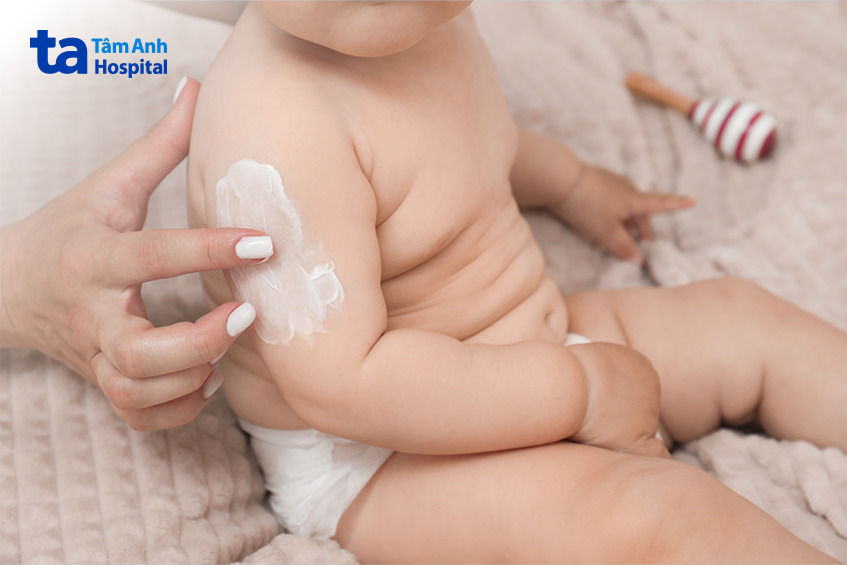 điều trị rối loạn sắc tố bẩm sinh