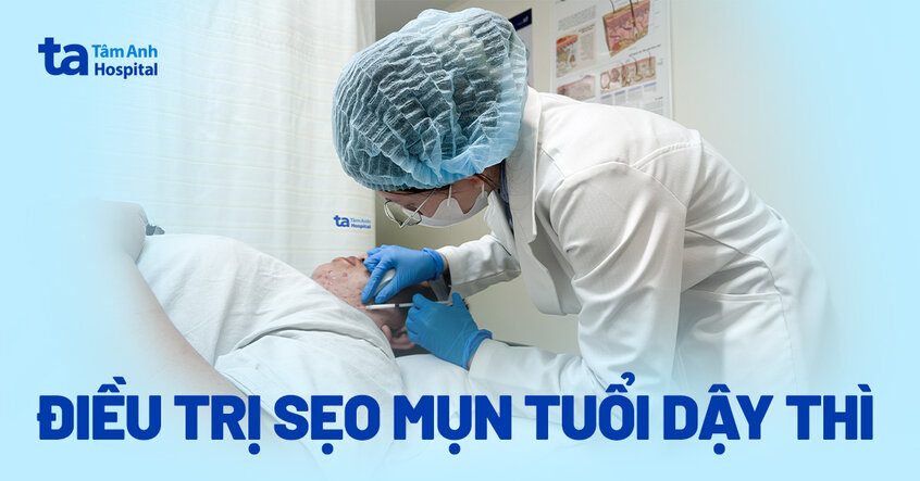 Nam sinh 16 tuổi bị sẹo lồi chi chít do mụn tuổi dậy thì