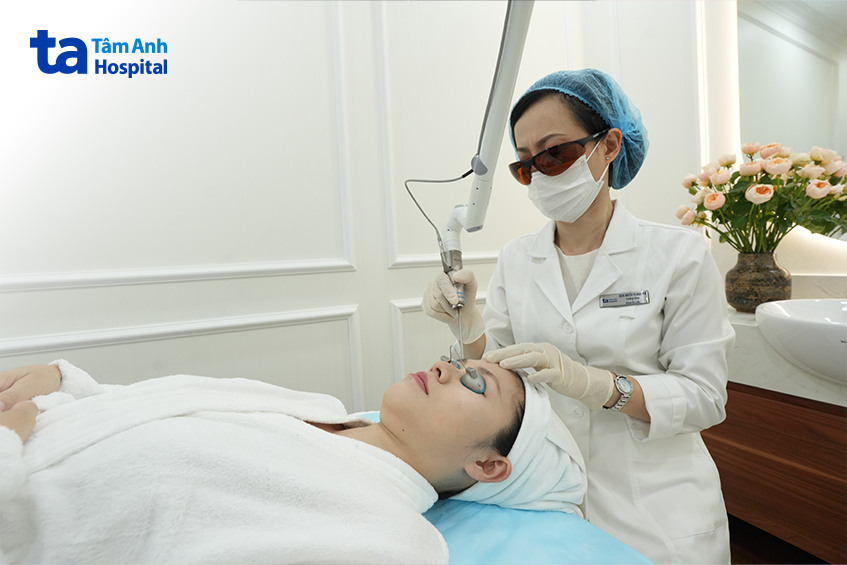 điều trị tăng sắc tố da