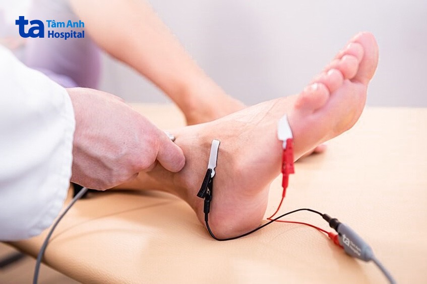 đo điện cơ chân để đánh giá chức năng của cơ và thần kinh