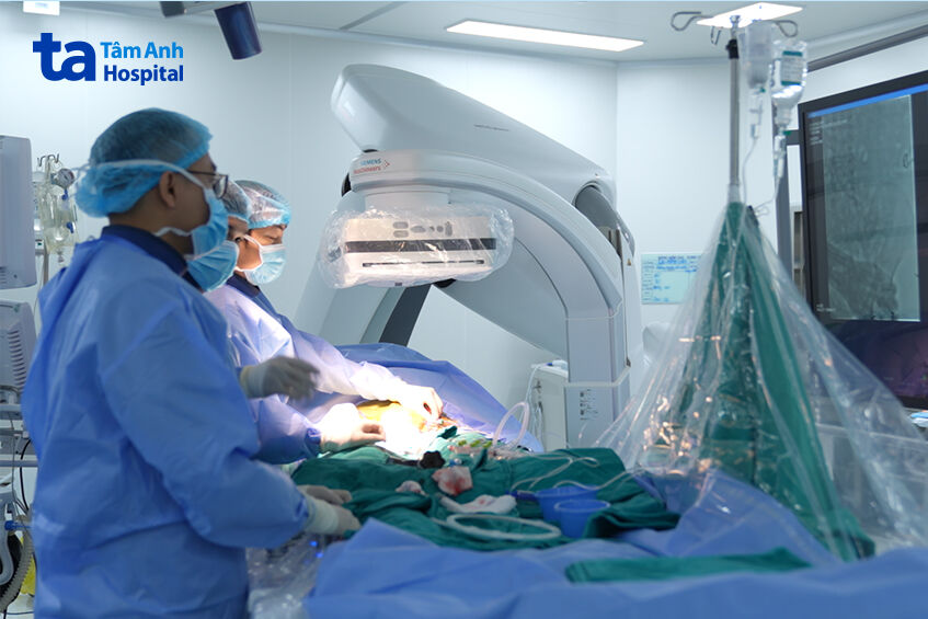 Êkíp đặt stent graft trong lòng mạch để loại bỏ túi phình quai động mạch chủ