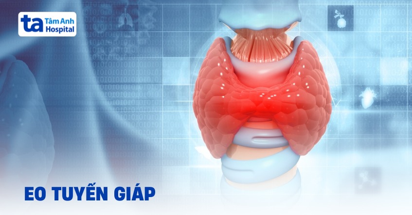 Eo tuyến giáp nằm ở đâu? Có chức năng gì?