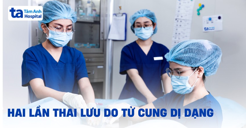 Hai lần thai lưu do tử cung dị dạng