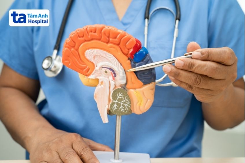 hay quên có thể cảnh báo u não