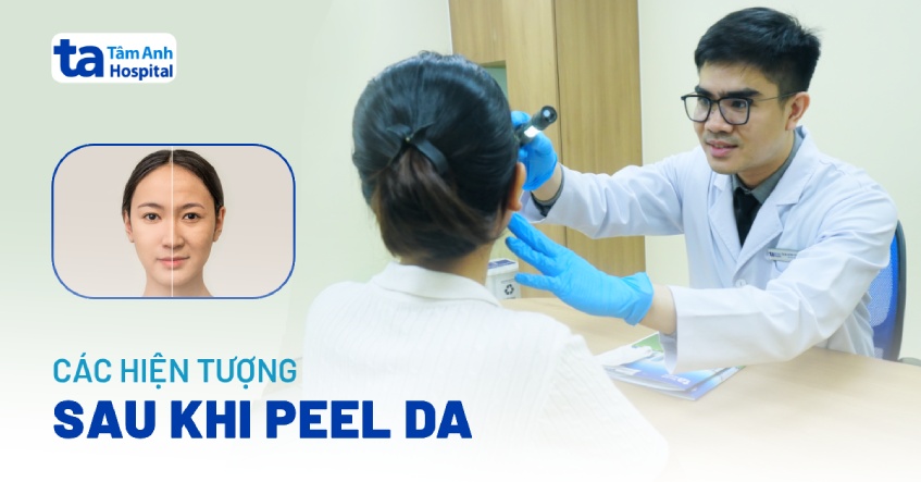 Một số hiện tượng sau khi peel da có thể bạn chưa biết