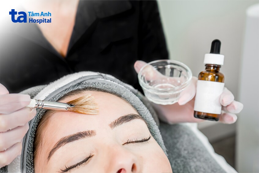 hiệu quả của peel da trong điều trị sẹo rỗ