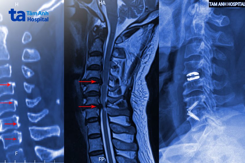 hình ảnh tổn thương bệnh nhân được khắc phục