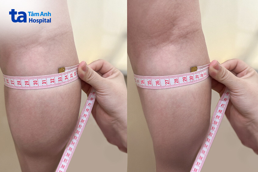 hình ảnh trước và sau khi điều trị của khách hàng