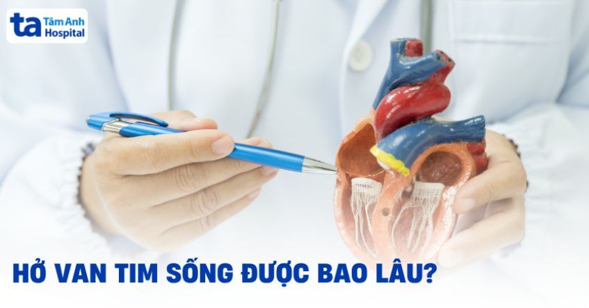 Bị hở van tim sống được bao lâu? Làm sao để kéo dài tuổi thọ hơn?