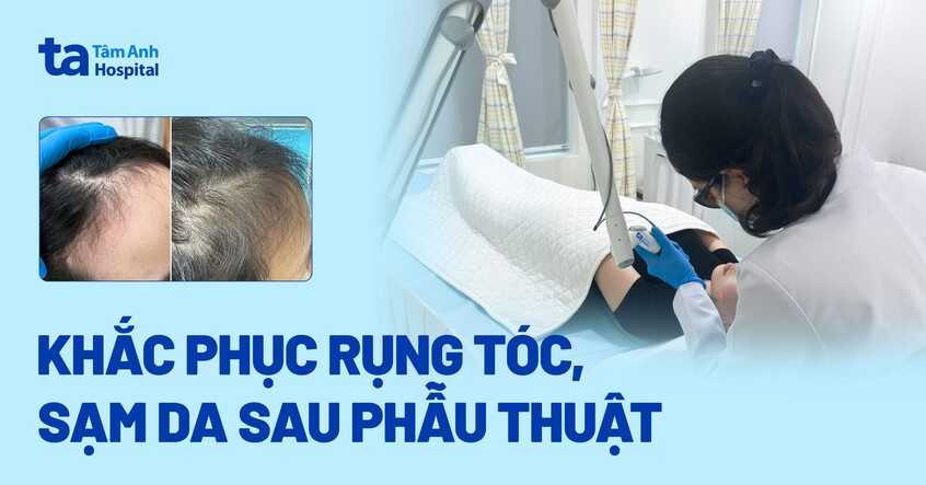 Khắc phục rụng tóc, sạm da sau phẫu thuật