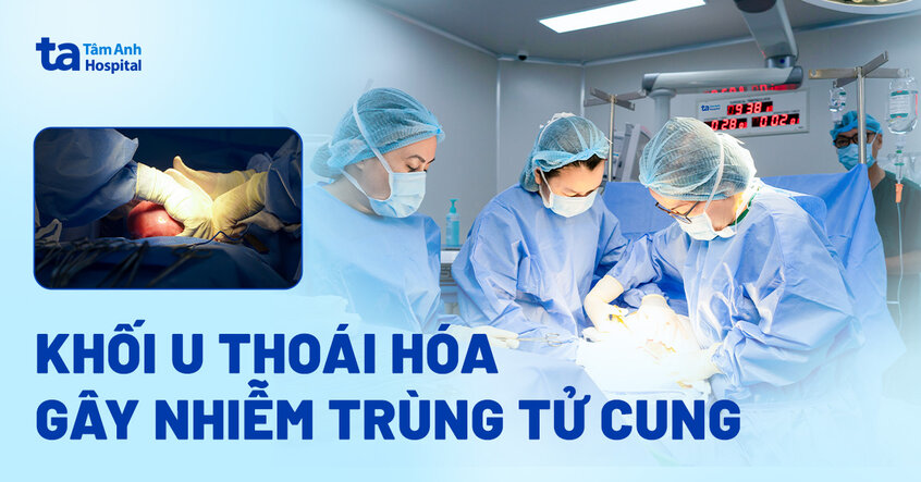 Khối u xơ thoái hóa gây nhiễm trùng tử cung