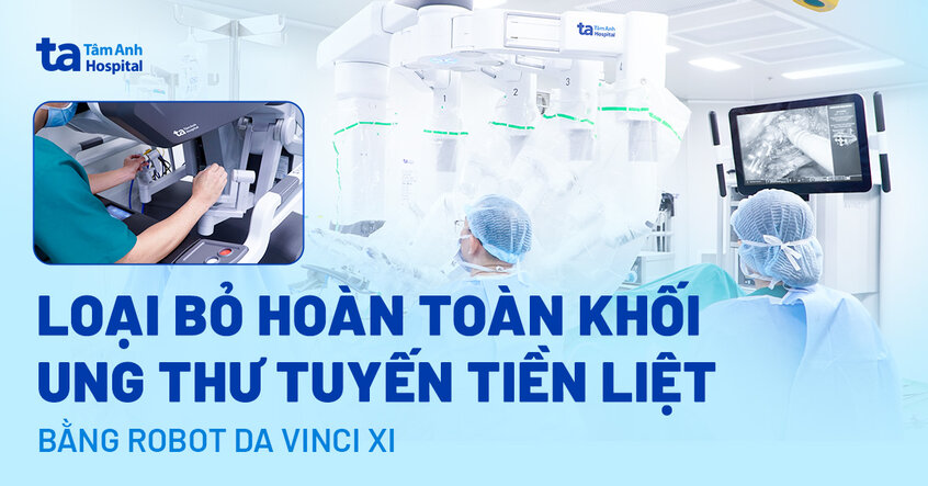 Loại bỏ hoàn toàn khối ung thư tuyến tiền liệt bằng Robot Da Vinci Xi