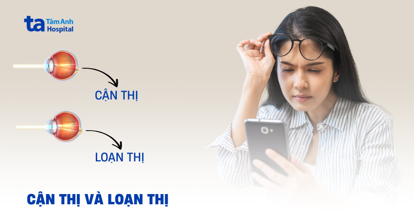 Phân biệt loạn thị khác gì cận thị, cái nào nặng hơn?