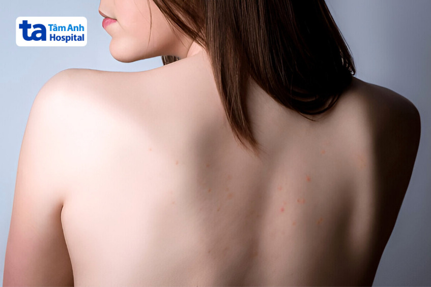 Peel Lưng Và Những Lợi Ích Nổi Bật Lợi Ích Khi Peel Vùng Lưng
