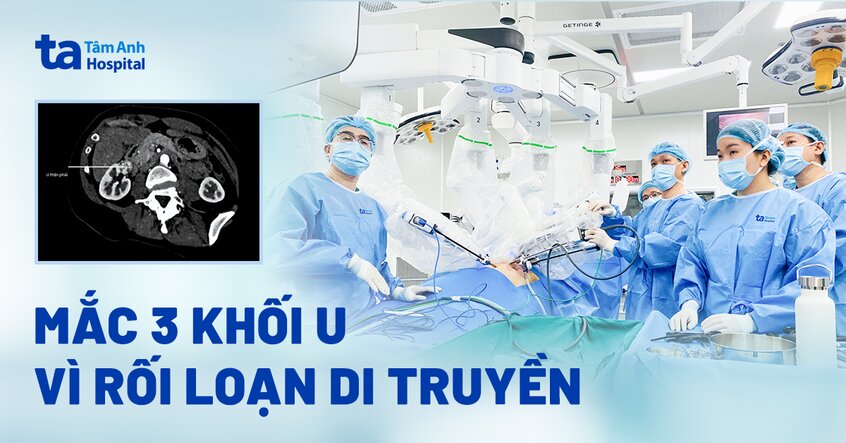 Mắc 3 khối u vì rối loạn di truyền