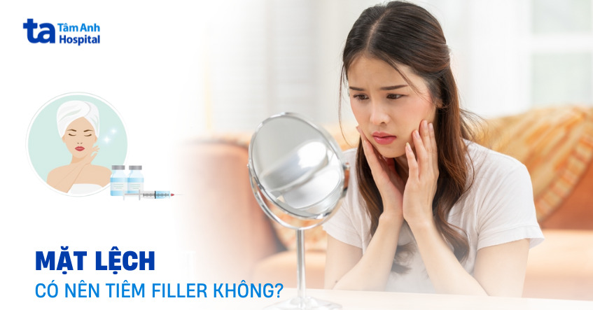 Mặt lệch có tiêm filler được không?