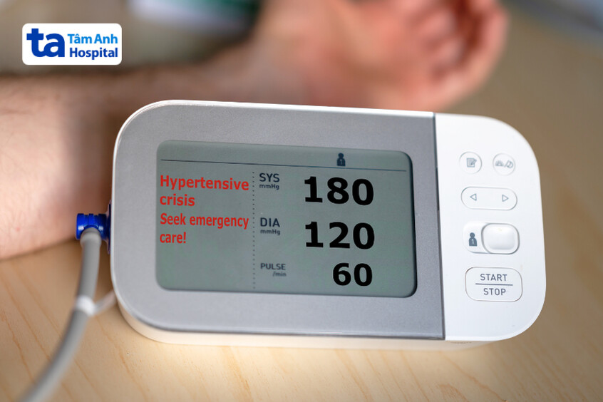 Mức độ 3 là trường hợp nguy cấp được xác định khi kết quả đo huyết áp >= 180/120 mmHg