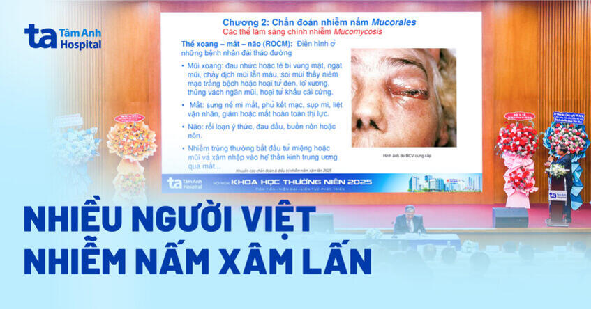 Nhiều người Việt nhiễm nấm xâm lấn