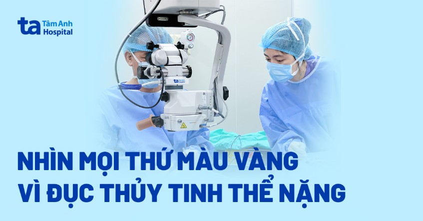 Nhìn mọi thứ màu vàng vì đục thủy tinh thể nặng