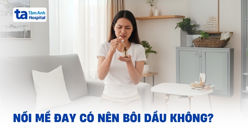 Giải đáp nhanh: Nổi mề đay có nên bôi dầu gió không?