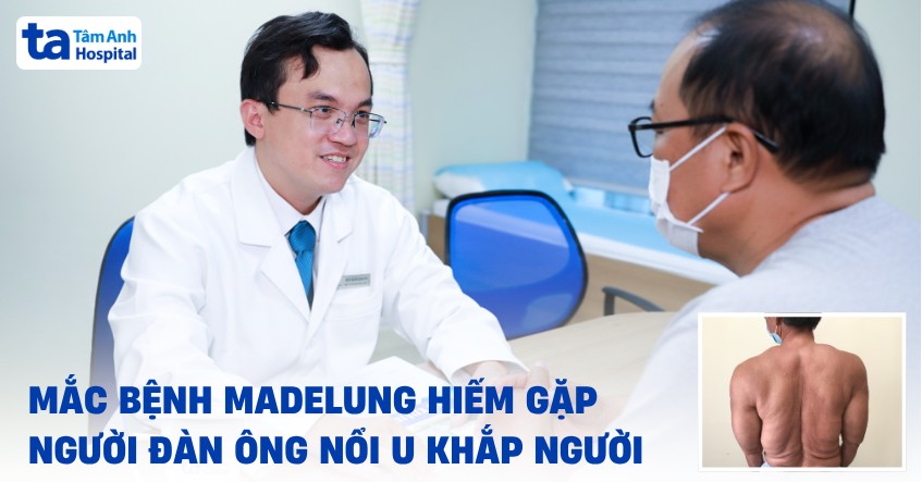 Nổi u khắp người do mắc bệnh Madelung hiếm gặp